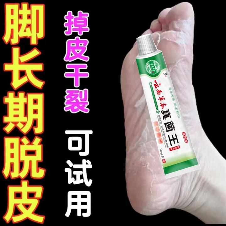 脚痒脚臭止痒膏去脚出汗脱皮起水泡干裂脚趾缝痒喷剂抑菌止痒神器