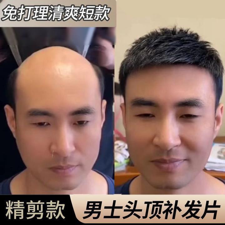 假发男短发毛寸男士头顶补发自然无痕隐形假发片真人发丝薄