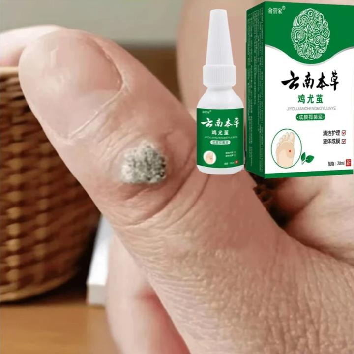 云南本草滴液脚老茧脚垫脚茧硬皮死皮软化剂脚后跟脚底老茧去角质