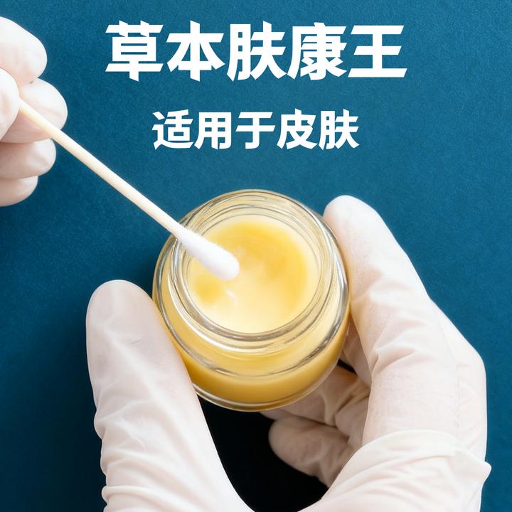 【炉甘石抑菌王】加强版草本萃取清凉护肤乳膏不粘腻手足全身可涂抹