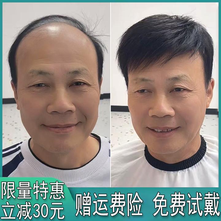 男士假发全真发精剪自然头顶式补发块自然隐形无痕遮白发补发片款