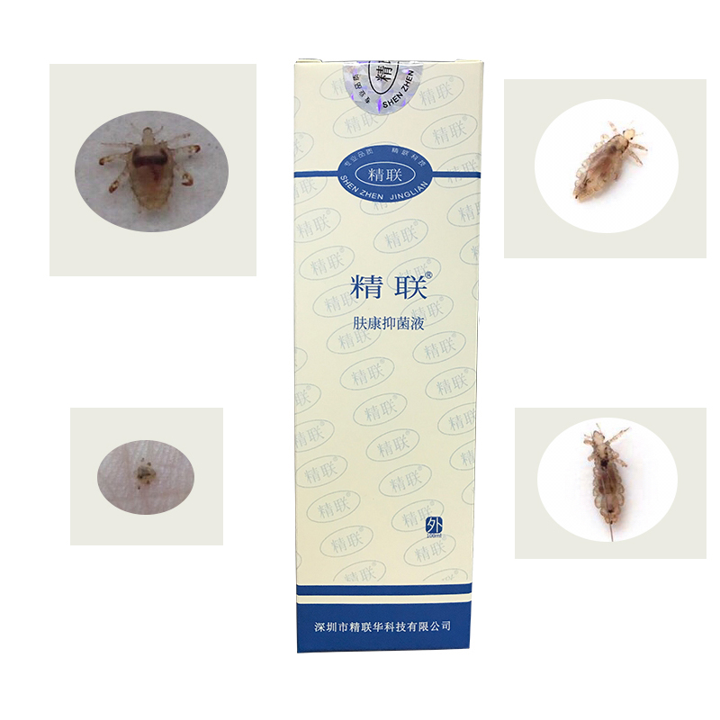 精联肤康抑菌液成人灭除体表毛发中的小虫子阴虱头虱体虱卵虱子