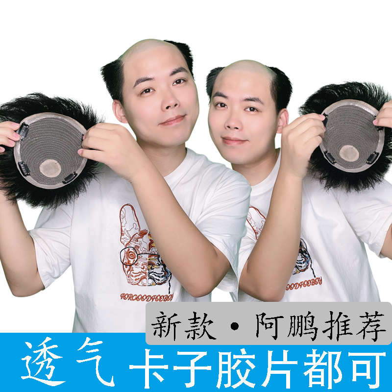 （机制款可粘胶可用卡）假发男士真发补发片男补发块机制可粘胶卡