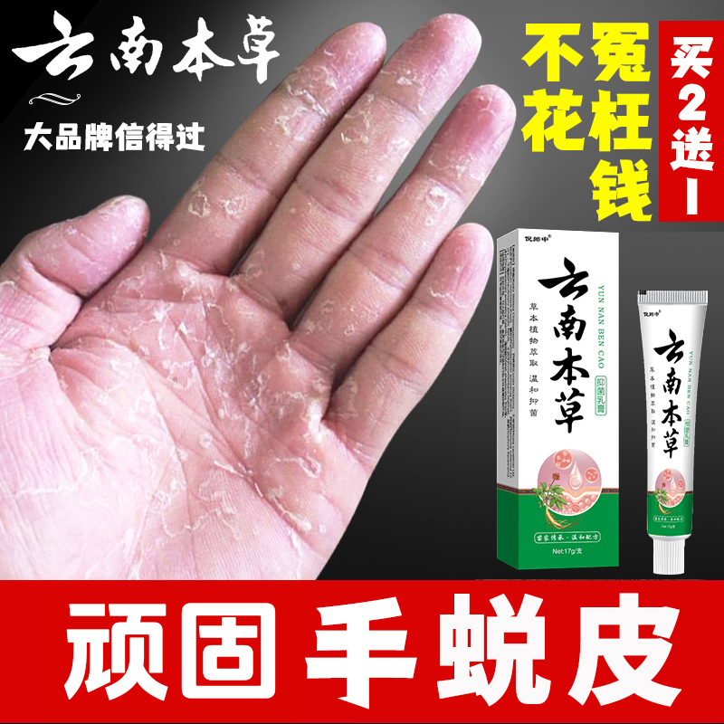 云南本草膏手足脱皮膏草本精粹外用手脚部脱皮干裂抑菌止痒干软膏
