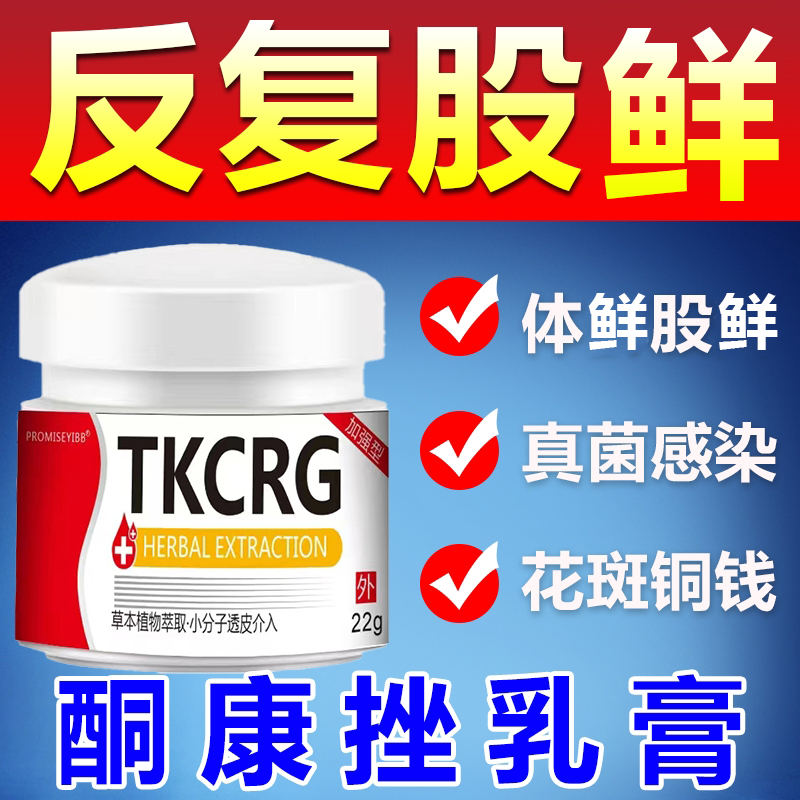 酮康唑2%*22g用于手鲜 足鲜 体鲜 股鲜 脚痒 花斑鲜 抑菌止痒乳膏