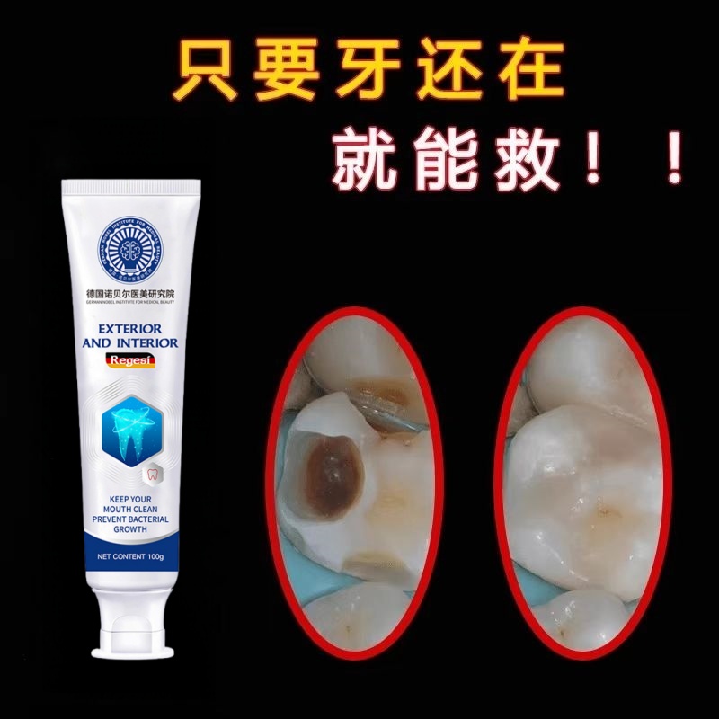 【德国研究院】蛀牙专用牙膏牙黄牙黑敏感大牌护理牙膏