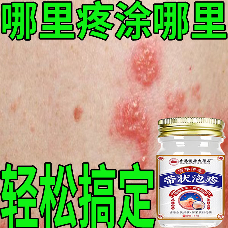 带状泡疹后遗神经痛蛇盘疮膏蛇盘清宝带状疱疹后遗症神经痛特效药