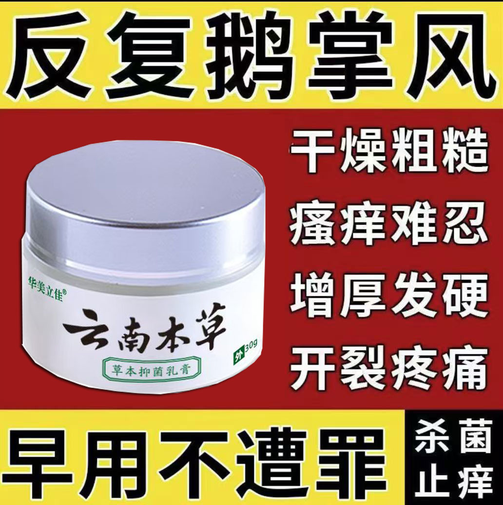 手足裂口脱皮鹅掌风发痒手上干裂脱皮干痒止痒草本正品抑菌软膏