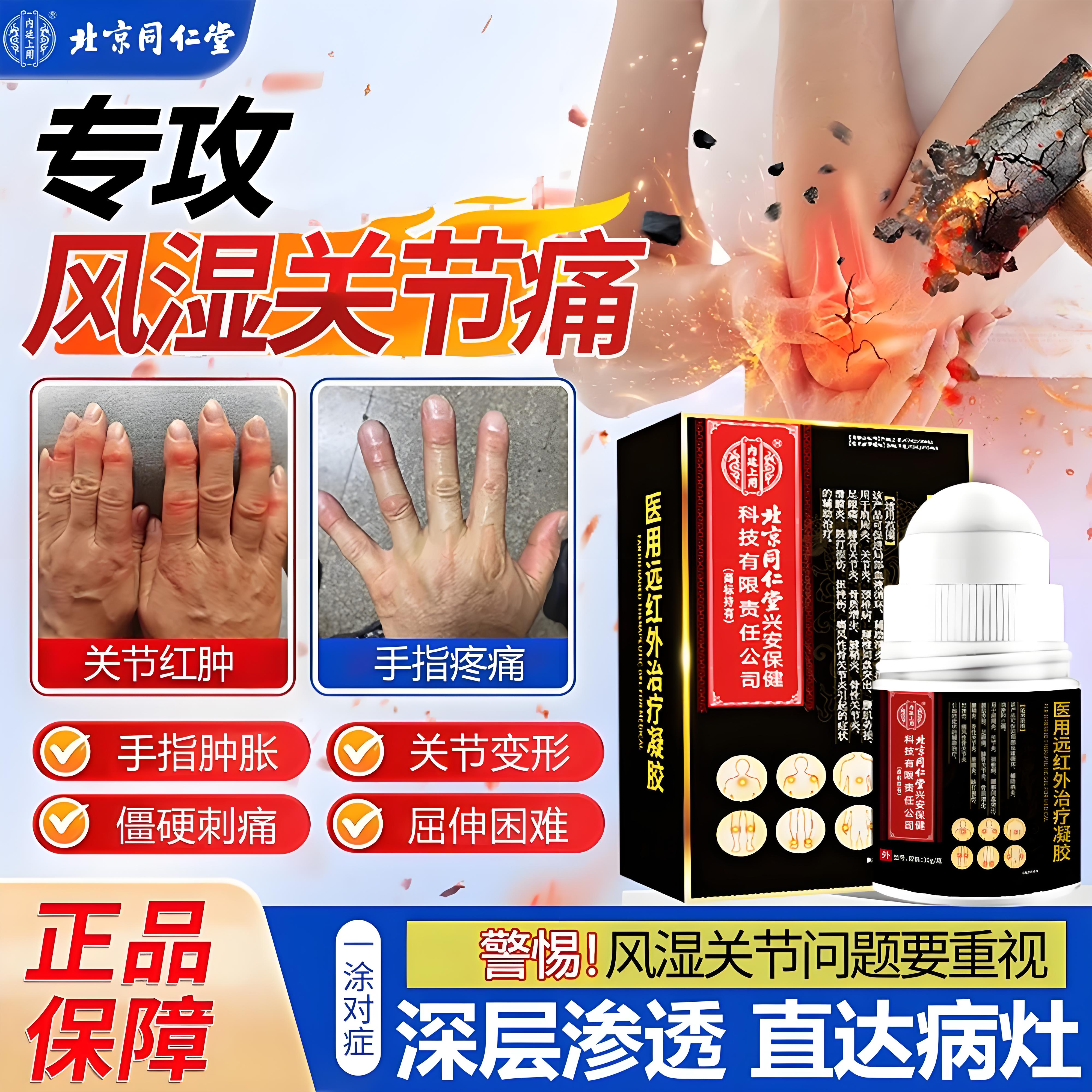 北京同仁堂药业风湿性关节炎专用风湿关节疼痛变形红肿手指关节疼灼热受凉刺痛外涂消喷剂 医用远红外治疗凝胶内廷上用