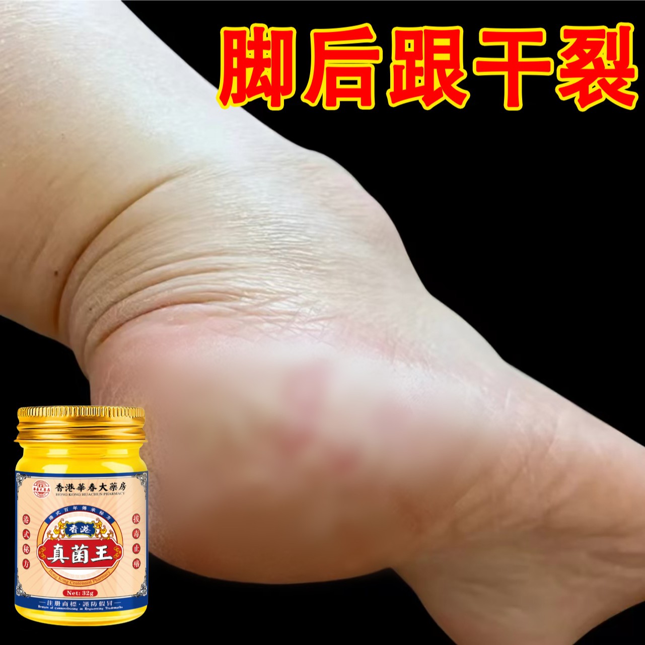 真菌王脚后跟开裂秋冬季神器防裂膏手足干裂痒真菌感染抑菌止痒膏