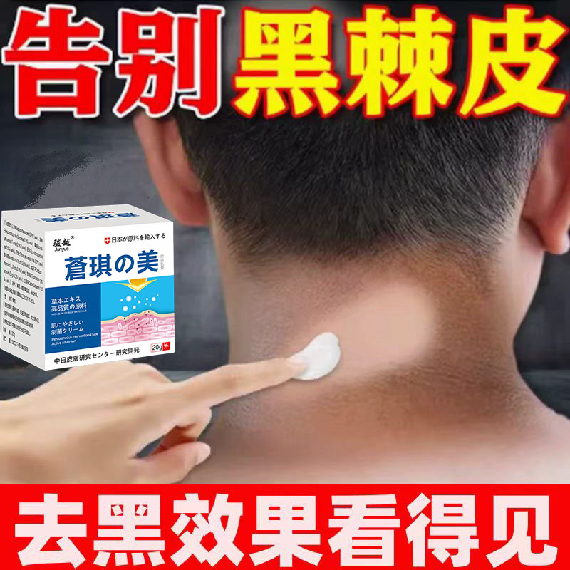 脖子黑黑的黑棘皮症去除脖子黑色素沉淀洗不干净嫩白神器沉淀膏
