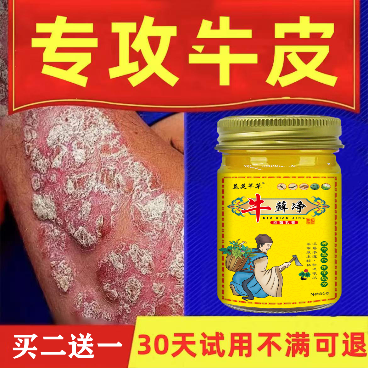 【牛藓净】全身牛皮廯/银屑藓头藓体藓皮焱湿诊止痒膏草本抑菌外用
