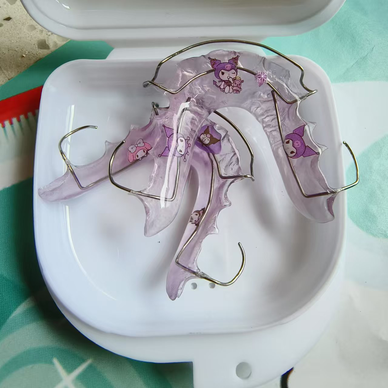 定制哈雷钢丝保持器防反弹拉紧器门牙牙缝大收紧器透明牙套哈雷