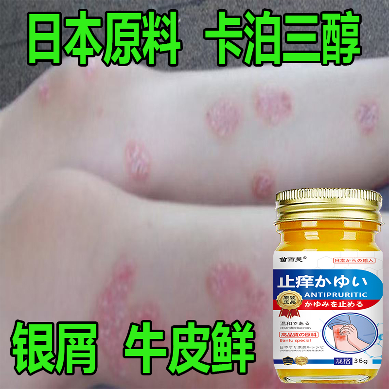 牛皮专用银屑顽鲜卡泊三淳倍他米软膏手足体股头鲜全身草本止痒膏