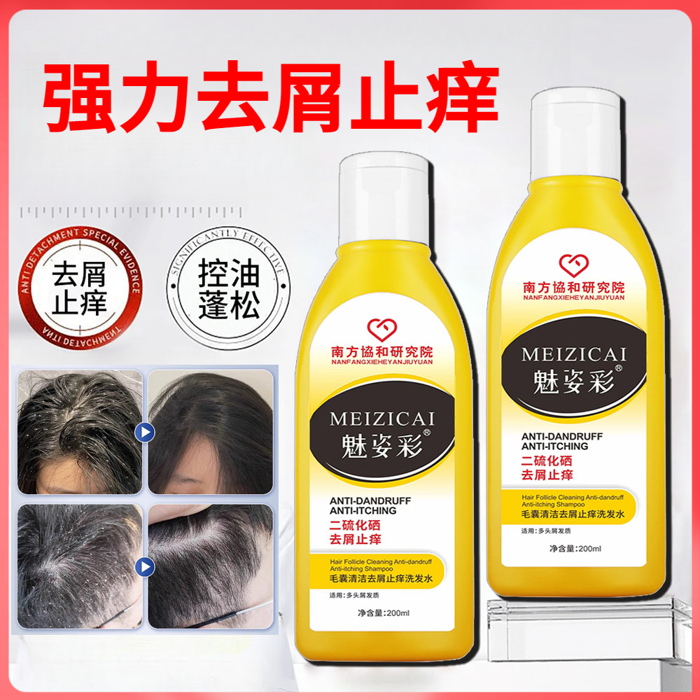 二硫化硒洗发水熬夜控油去屑头皮疙瘩头痒持久留香蓬松净爽洗发水