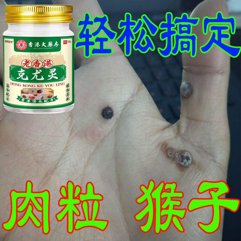 【小肉粒专用】老香港克尤灵去脖子肉粒手足腋下丝状扁平肉刺乳膏