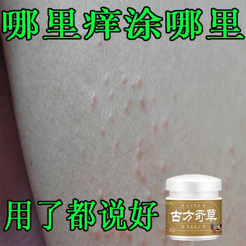 古方奇草草本全身止痒膏皮肤膏温和涂抹亲肤正品