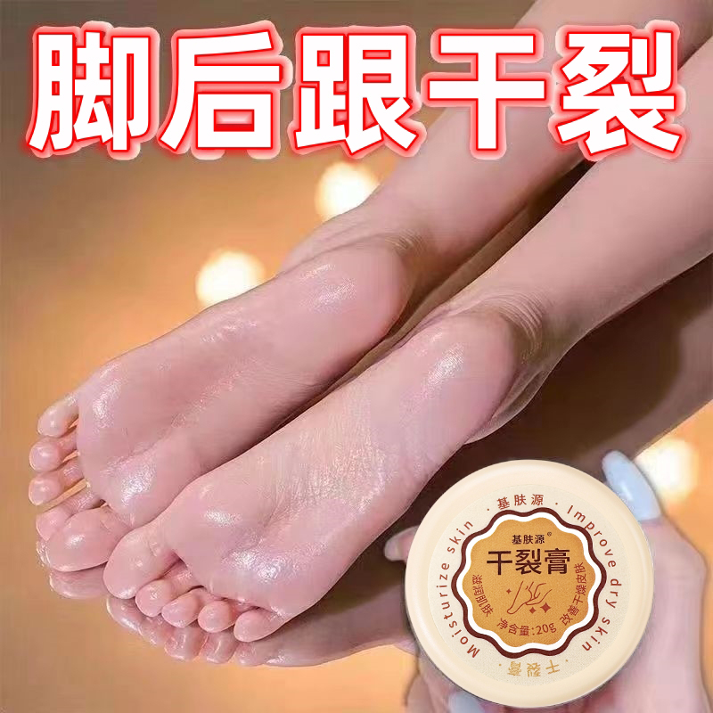 基肤源手足干裂膏滋润嫩滑脱皮手唇膏保湿护足霜补水修护防干脚干