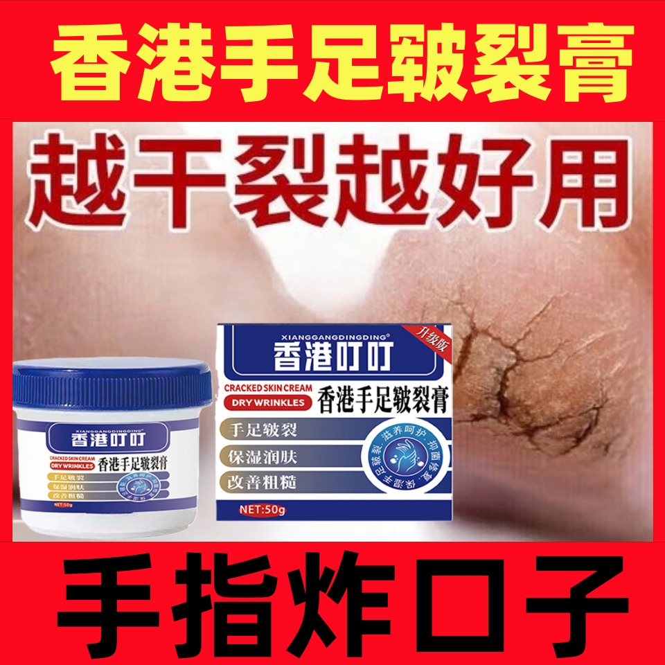 皴裂手足滋润护理修护脚后跟干裂脚后跟干裂滋润皴裂膏皲裂修复