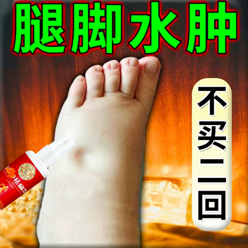 腿脚水肿专用喷雾四肢浮肿大小腿肿老人下肢全身水肿脚肿穿鞋困难