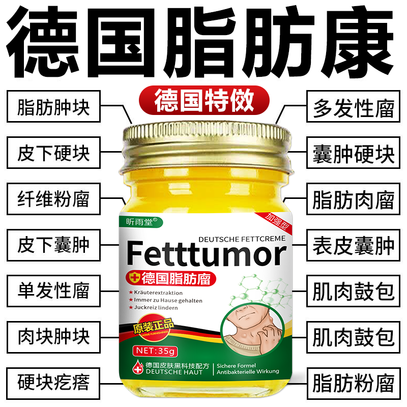 德国脂肪康正品肿块膏脂肪灵瘤膏皮下硬块单发性多发性涂抹膏