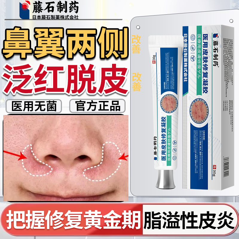 藤石制药鼻子两侧脂溢性皮炎专用鼻沟发红鼻子两侧泛红修复霜膏干燥起皮脱皮化妆卡粉药监备案皮肤屏障受损医用皮肤修复凝胶Q2
