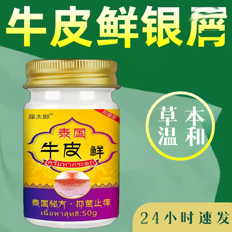 银鲜牛皮鲜手足皮肤止痒膏外用