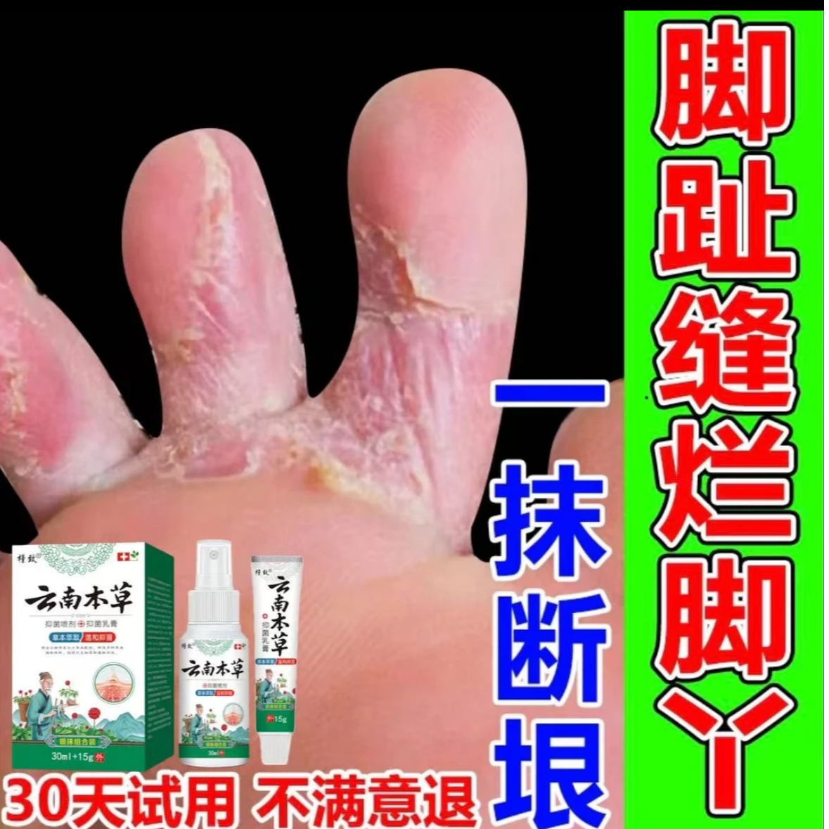 【官方正品】云南本草脚痒脚脱皮喷脚王脚臭起水泡脚汗抑菌止痒喷剂
