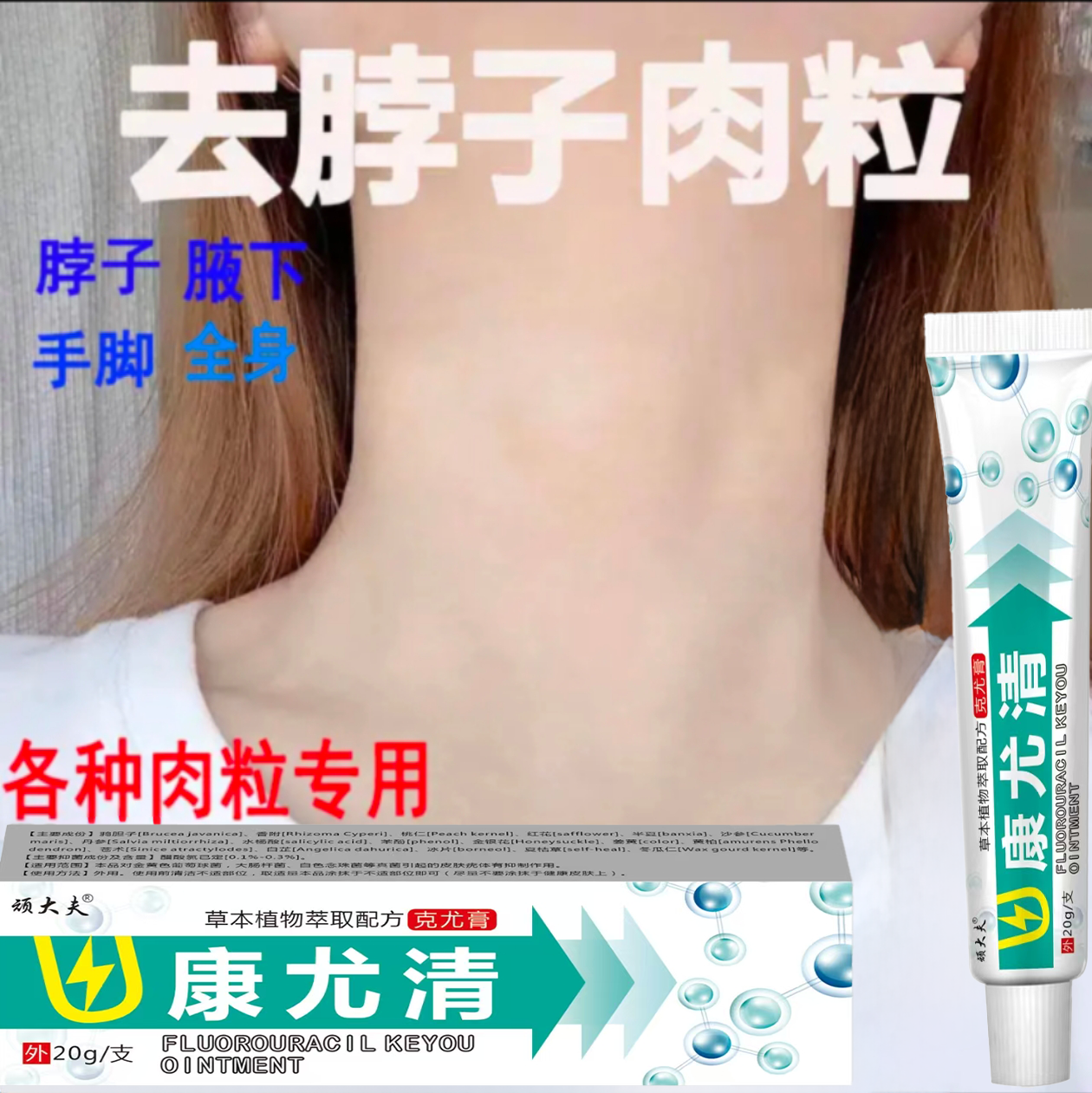 【小肉粒专用】顽大夫正品康尤清脖子手足腋下丝状扁平肉刺