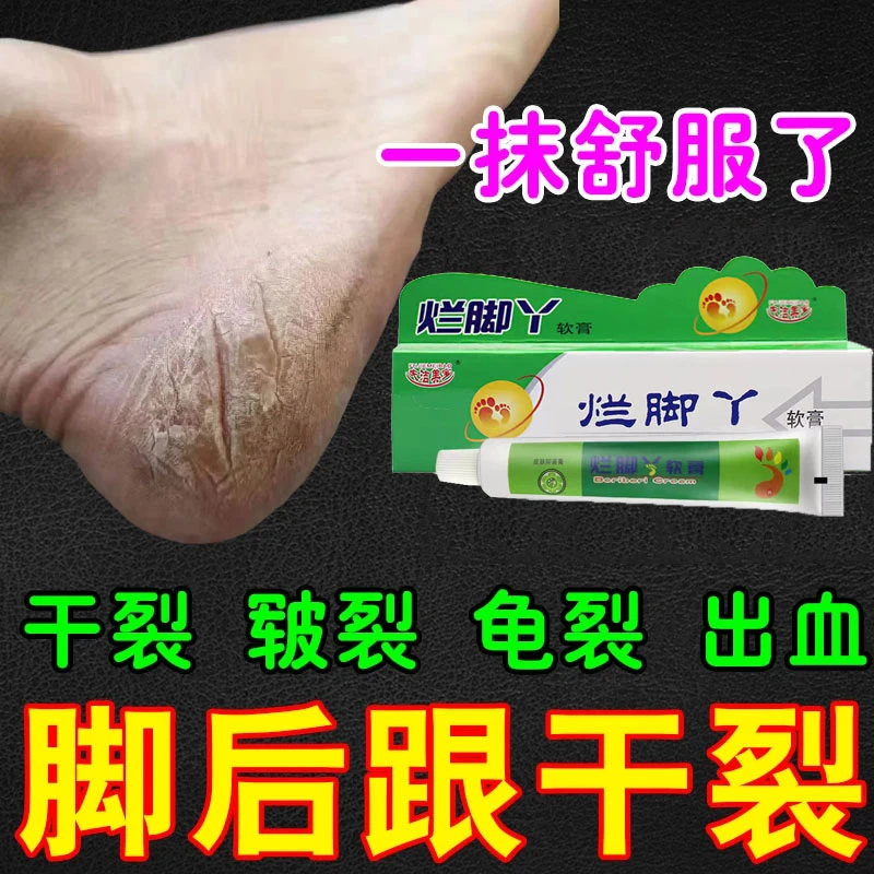 【不怕试】脚后跟干裂修复霜皲裂手足龟裂足裂开裂治手脚底开裂脱皮