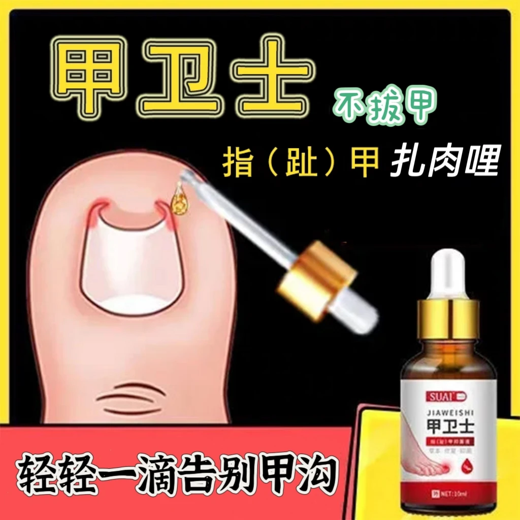 【甲沟*炎专用】甲卫士去肉芽手指脚趾甲长肉里修护液抑菌草本萃取