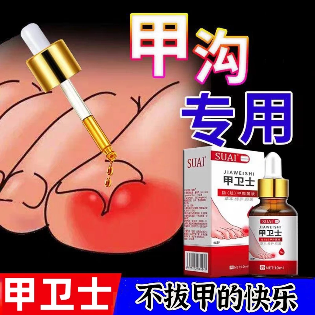 甲卫士甲沟抑菌液外用涂抹脚部草本甲勾嵌甲指甲修护液生甲温和