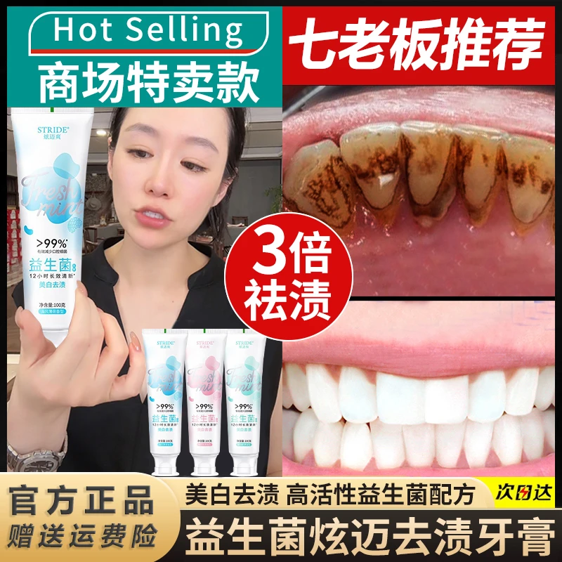 【清新口气】益生菌牙膏去黄去烟渍持久留香清新口气亮白护龈男女士