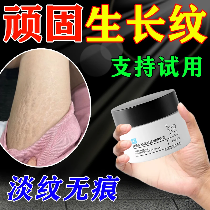 腰腹部生长纹紫纹肥胖纹生长纹大腿学生腰腹上肥胖纹男女通用膏
