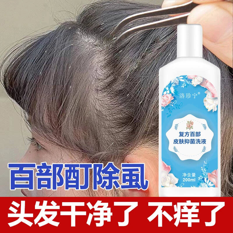 去虱子与虱子卵的洗发水除虱抑菌大人孩子通用小女孩头发