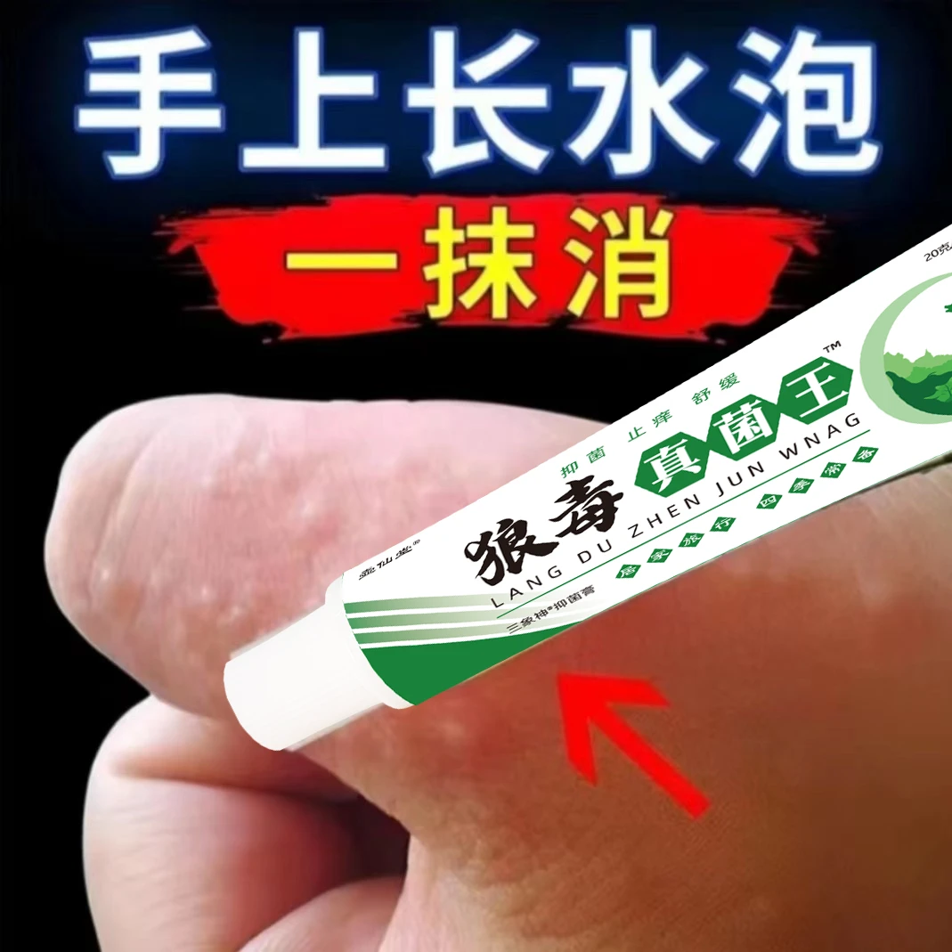 【官方正品】狼毒真菌王止痒快克湿疹皮肤抑菌膏止痒膏草本乳膏