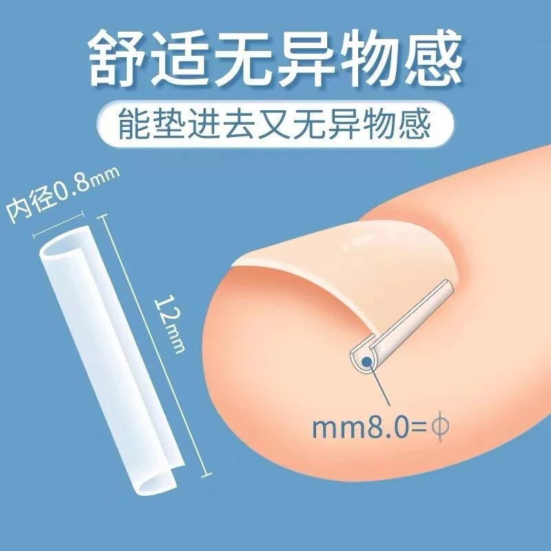 指甲矫正指甲往肉里长专用嵌甲正甲贴垫片