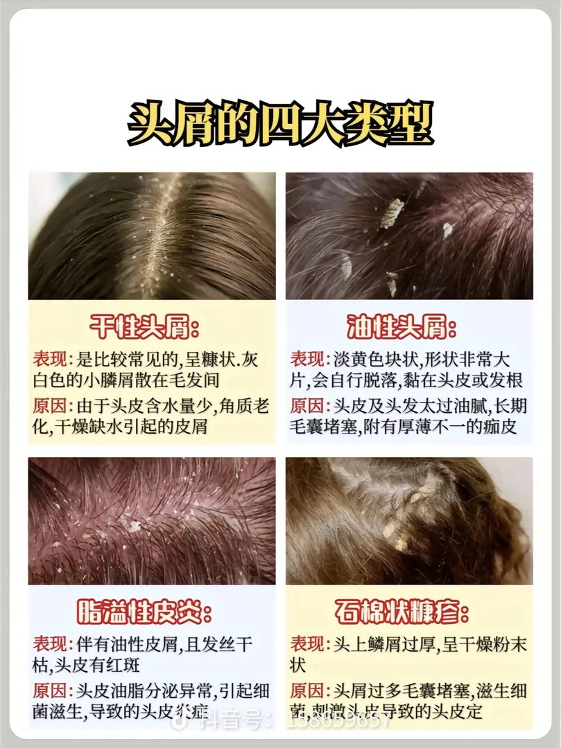 强力去屑止痒净爽控油洗发水舒缓清洁清爽