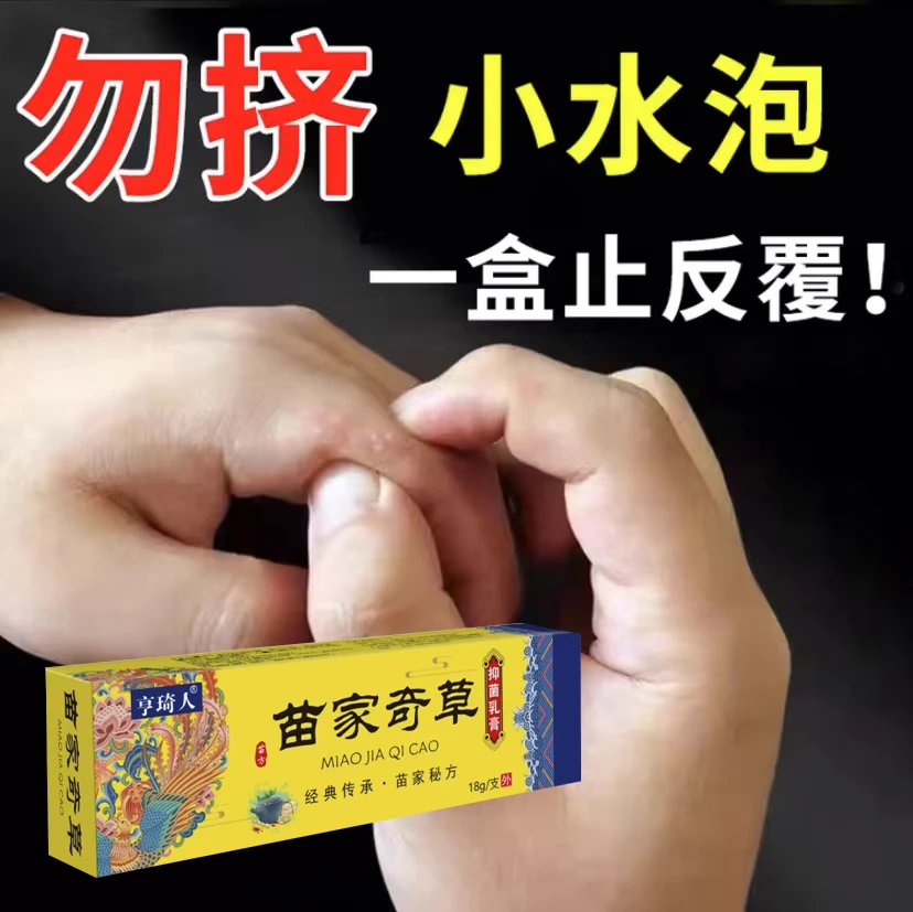 手上起小水泡手足脱皮膏开裂止痒手痒水泡