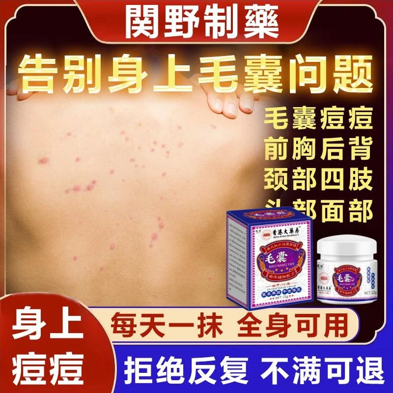 毛囊膏前胸后背脸肩颈部皮肤红肿痘痘脓疙瘩毛囊净膏正品涂抹专用