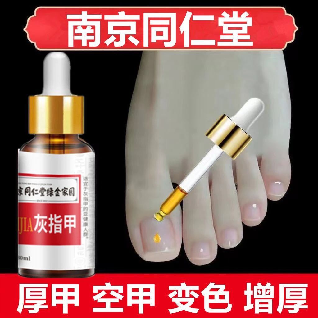 南京同仁堂凤仙花抑菌液灰趾指甲亮甲草本去坏软甲修护脚指甲专用