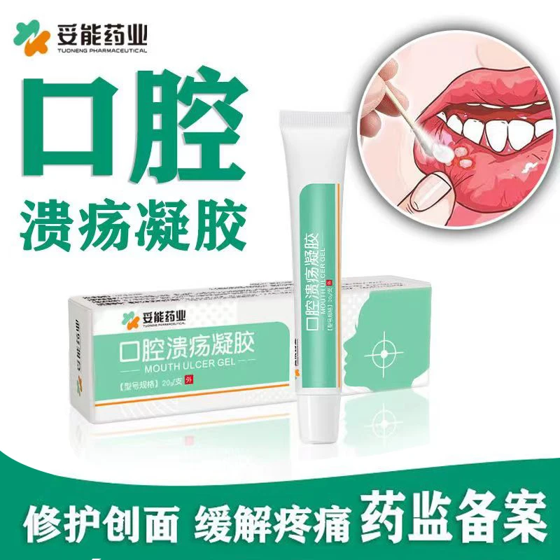 妥能药业医用口腔溃疡凝胶口角炎嘴唇起泡可用孕妇儿童上火止痛