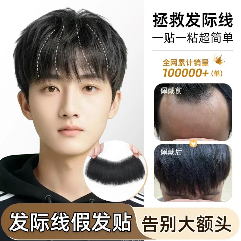 发际线假发贴前额神器刘海遮盖m型额头男款男士全真发假发片