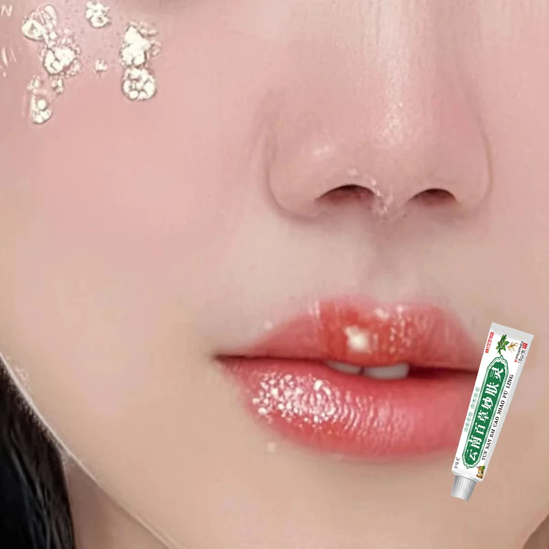 嘴唇起泡起水泡上火嘴巴上红肿起皮脱皮发痒嘴角裂口干裂疼痛膏