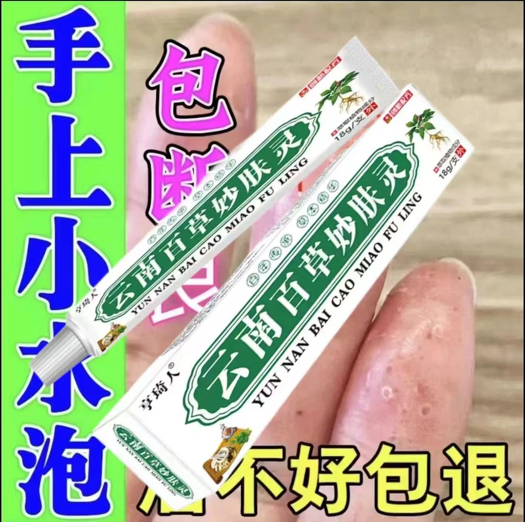 手上起小水·泡汗状水·泡痒手指脱皮专用手足脱皮抑菌膏