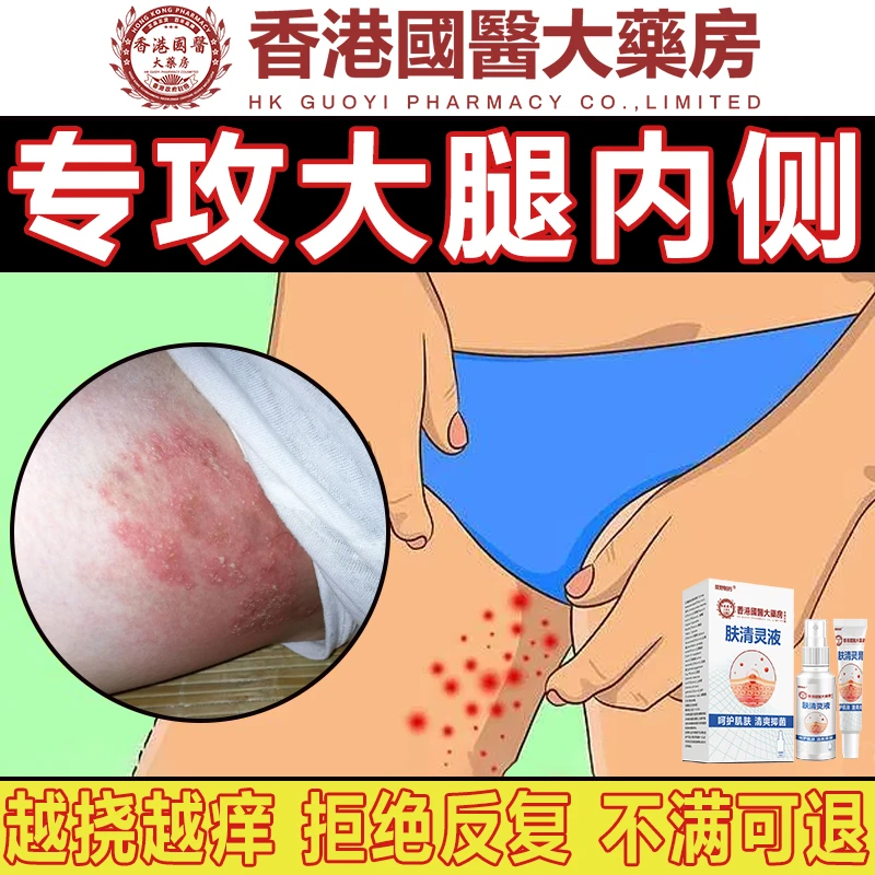 大腿内侧痒去潮湿男士大腿内侧出汗痒大腿内侧止痒膏下体痒