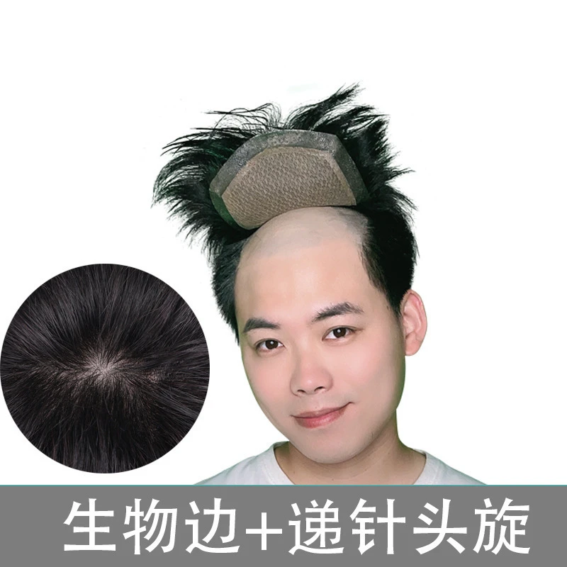 （递针头旋）男士假发全手织递针旋生物头皮秃顶地中海假发脱发男
