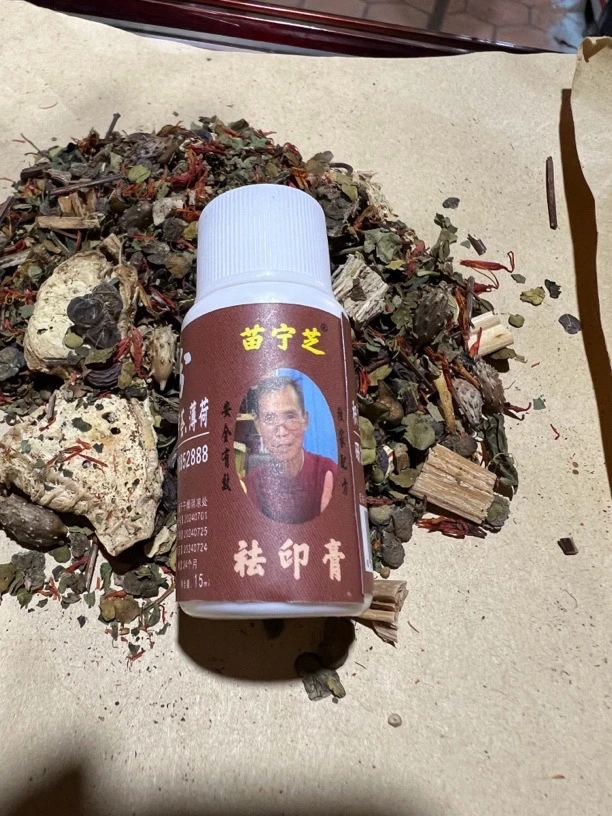 痘印用黑色素红色素修复可以用15克