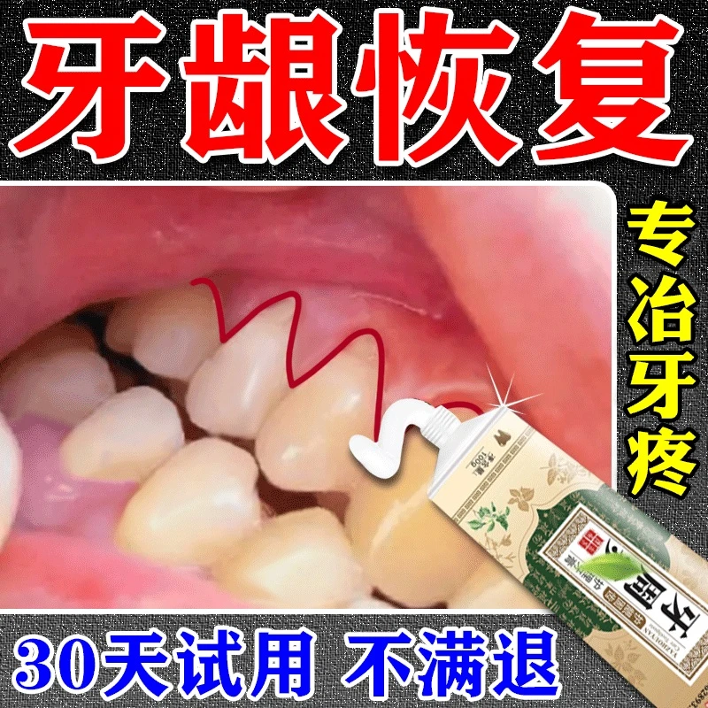 【牙疼克星】牙神经上火蛀牙虫牙疼痛牙龈痛红肿敏感蒲地蓝牙膏RL