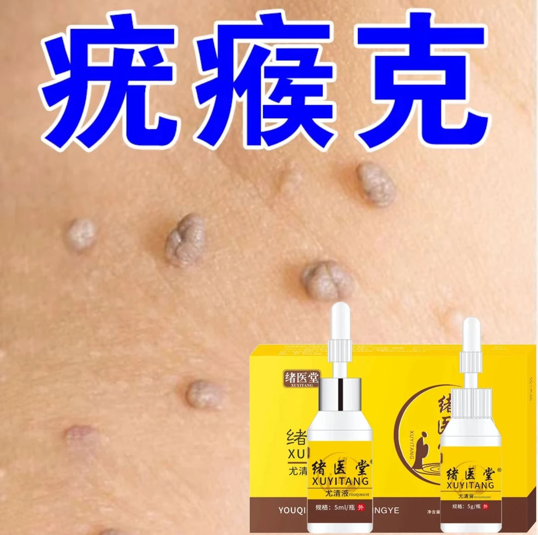 小肉粒手上腋下身小疙瘩脖子颈部上长神器手茧外用软化膏官方正品